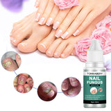 Nail Fungus Repairing Nourishing