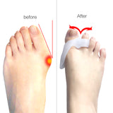 SILICONE BUNION CORRECTOR